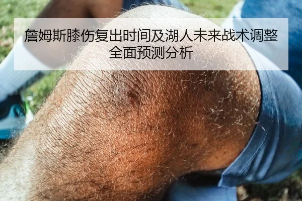 詹姆斯膝伤复出时间及湖人未来战术调整全面预测分析 | KAIYUAN GAMES